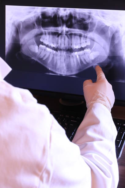 Best Emergency Tooth Extraction in Freeburg, IL