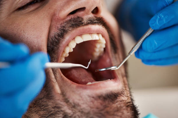 Best Emergency Denture Repair in Freeburg, IL